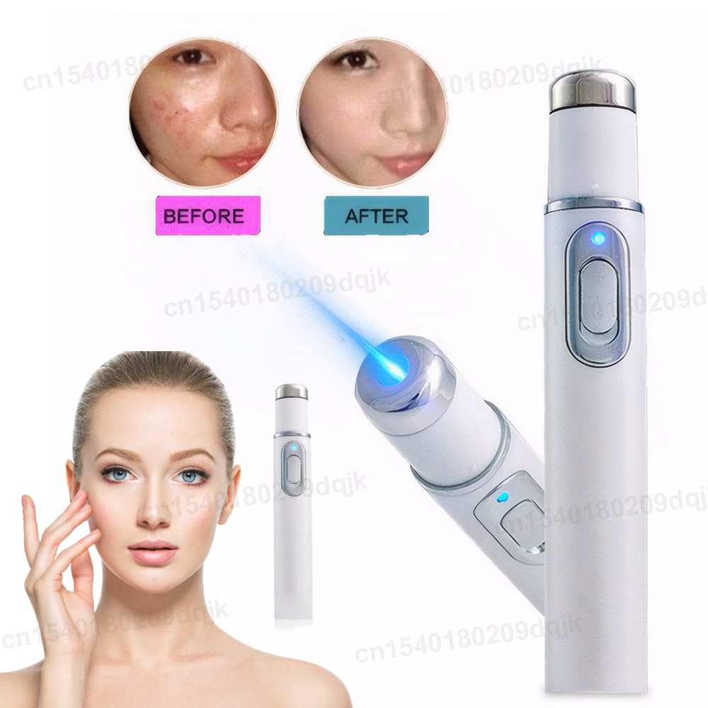 Acne Light Therapy Pen - Blue Light Therapy Acne Pen Heated