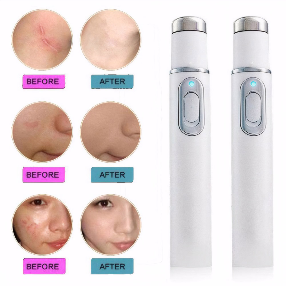 Blue Light Therapy Acne Pen He - Acne Light Therapy Pen recension och pris